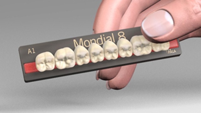 Mondial
