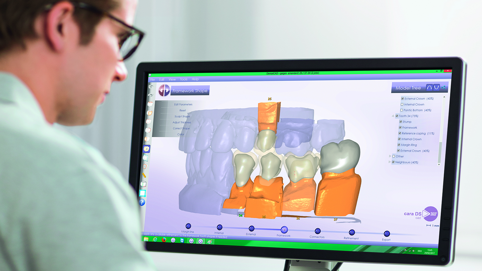 Kulzer CAD-CAM Solutions