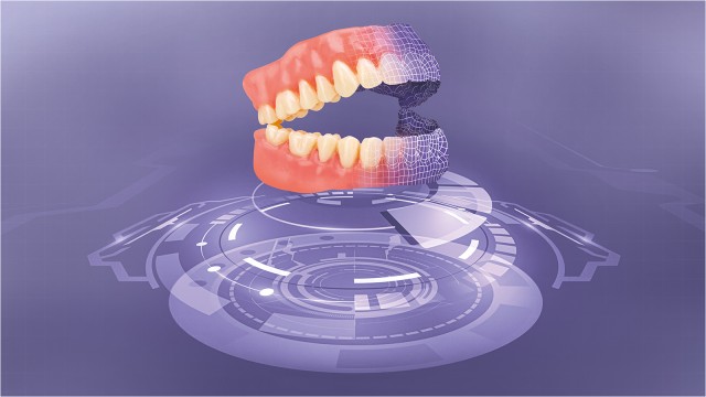 Digital Denture